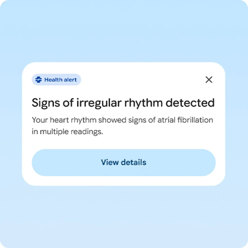 Alerte santé : rythme cardiaque irrégulier détecté, fibrillation auriculaire.
